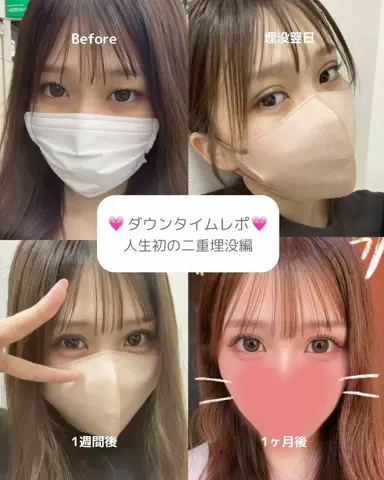垢抜け日記ちゃんのTikTok投稿
