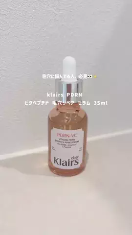 soruのTikTok投稿