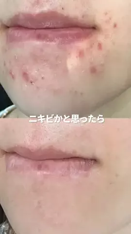 りな　美容オタクのTikTok投稿