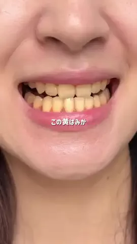 りこぴんのTikTok投稿