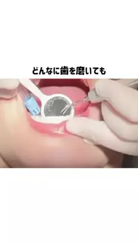 なるみ♡垢抜けのTikTok投稿