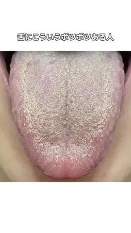 𝕄𝕠𝕖𝕜𝕒のTikTok投稿