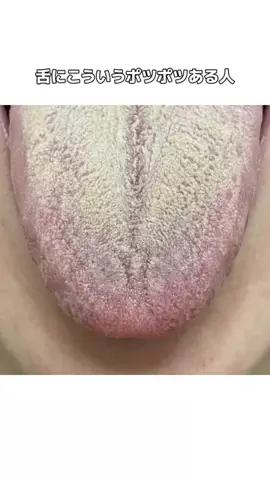 𝕄𝕠𝕖𝕜𝕒のTikTok投稿
