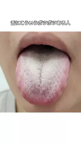 𝕄𝕠𝕖𝕜𝕒のTikTok投稿