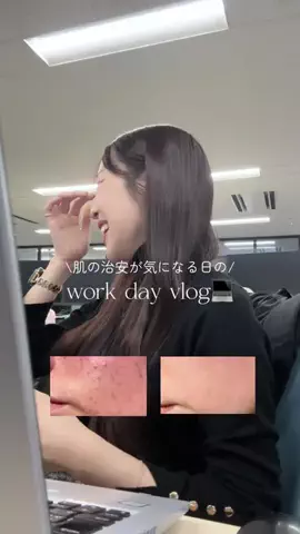 yuukaのTikTok PR投稿：肌の治安が気になる日のお仕事vlog‪🌱‬ #PR #ヴィーガン…