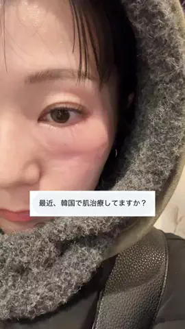 こみのTikTok投稿