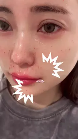 🍑もちゃころ🍑のTikTok投稿