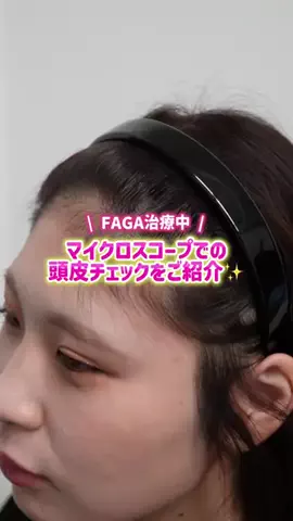 FAGAを改善する会社員のTikTok投稿