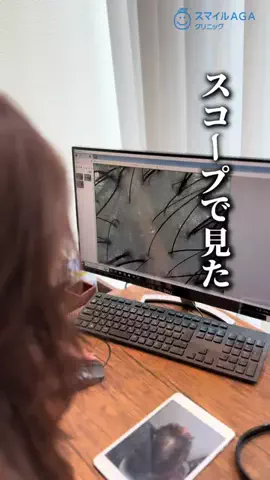 FAGAを改善する会社員のTikTok投稿