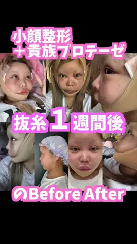 エレメンタルヒーロー‼️(本垢)のTikTok投稿