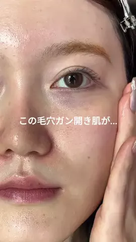 のあ@美容オタク🫧のTikTok投稿