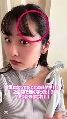Lily 🦷🍒のTikTok投稿