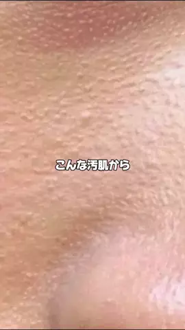ひびきちゃん🍓のTikTok投稿