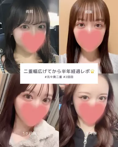 垢抜け日記ちゃんのTikTok投稿