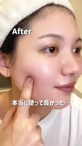 美白を目指すえみのTikTok投稿