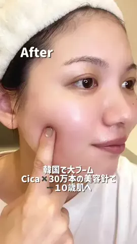 美白を目指すえみのTikTok投稿