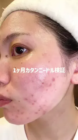 美白を目指すえみのTikTok投稿