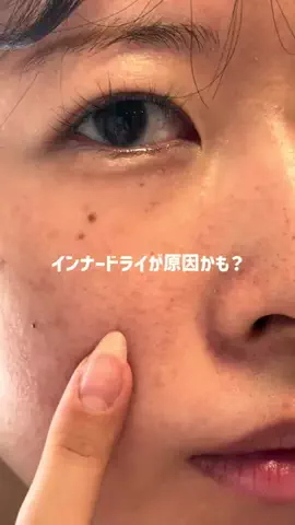 美白を目指すえみのTikTok投稿