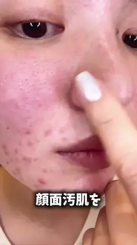 美白を目指すえみのTikTok投稿