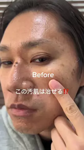 みなきメンズ美容のTikTok投稿