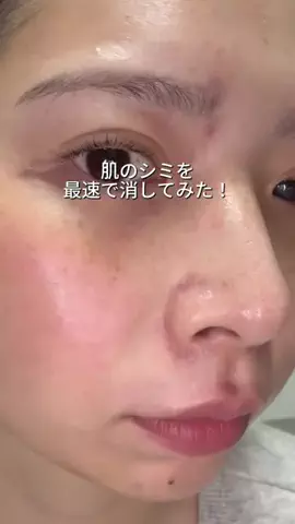 ビザちゃんのTikTok投稿