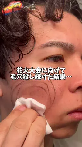 ケンティーのTikTok PR投稿：花火大会に向けて毛穴をケアし続けたら…嬉しい変化😭 …