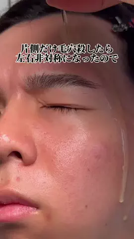 ケンティーのTikTok PR投稿：片側だけケアし続けたら、この左右差やばくない？😇 #PR…