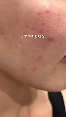 りんこ🫧美容｜コスメのTikTok投稿