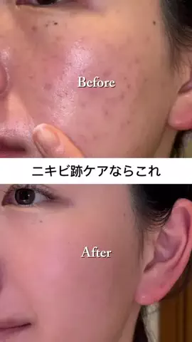 きららのTikTok投稿