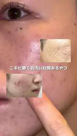 きららのTikTok投稿