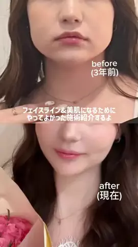 りな🌵のTikTok投稿