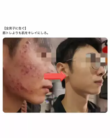 正直レビュー【モテ男美容】のTikTok投稿