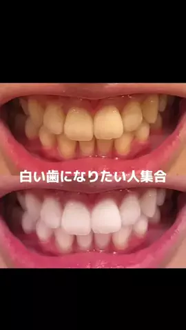 元ナースみか | アソコのお悩み相談室🏥のTikTok投稿