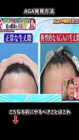 たまご肌姫のTikTok投稿