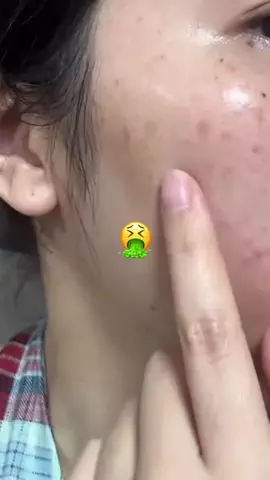 たまご肌姫のTikTok投稿