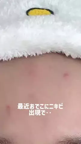 ばにらのTikTok投稿