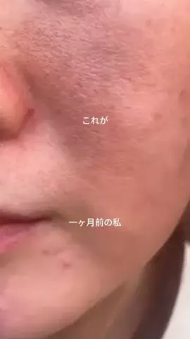 あや@垢抜けのTikTok投稿