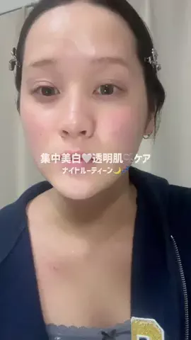 先天性眼瞼下垂(ゆな)のTikTok投稿