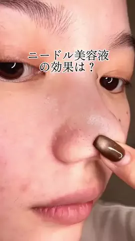 ゆい〻美容クリニック勤務のTikTok投稿