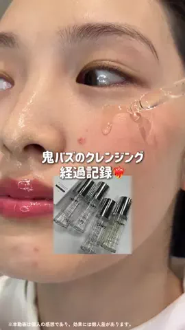 心配嬢👸🏻のTikTok投稿