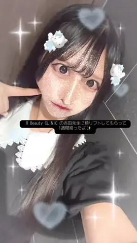 せなてんのTikTok投稿
