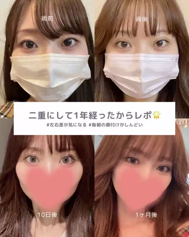 垢抜け日記ちゃんのTikTok投稿
