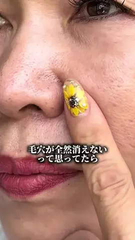 毛穴ちゃん🍓のTikTok投稿