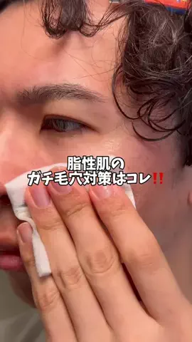ケンティーのTikTok PR投稿：俺と同じ脂性肌の人いる？ このやり方試してみてね✨️ …