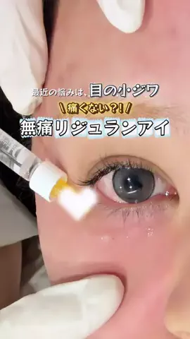 ヌンちゃんのTikTok投稿