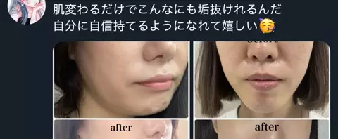 この ☃️ 【アンチエイジング】のTikTok投稿