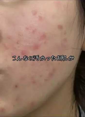 この ☃️ 【アンチエイジング】のTikTok投稿