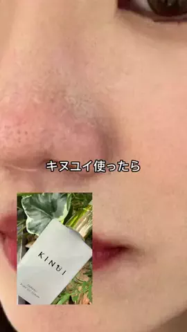 しお♡美白美活のTikTok投稿