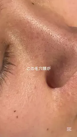 しお♡美白美活のTikTok投稿