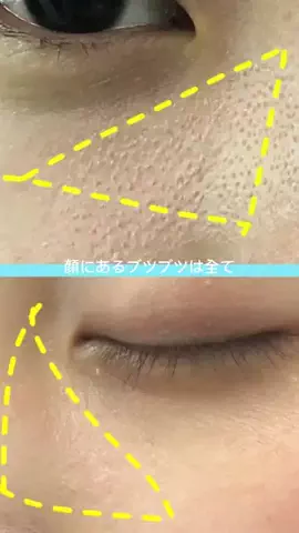 しお♡美白美活のTikTok投稿